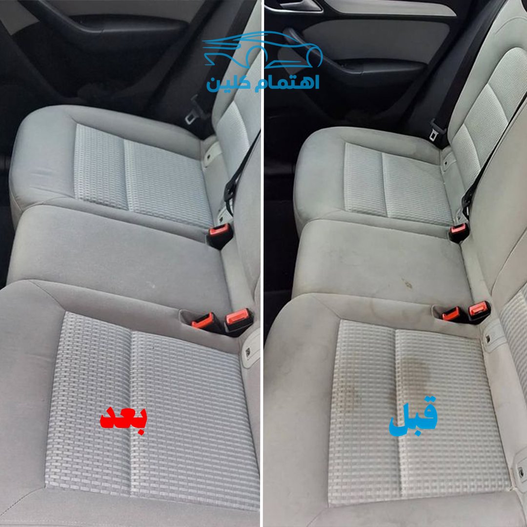 اهتمام [] قبل وبعد 1