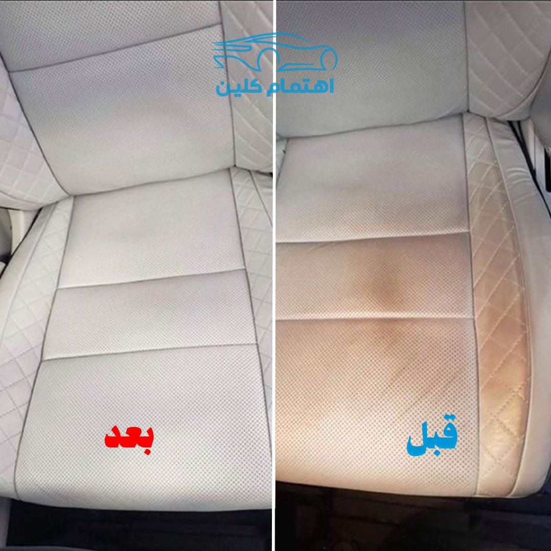 اهتمام [] قبل وبعد 2