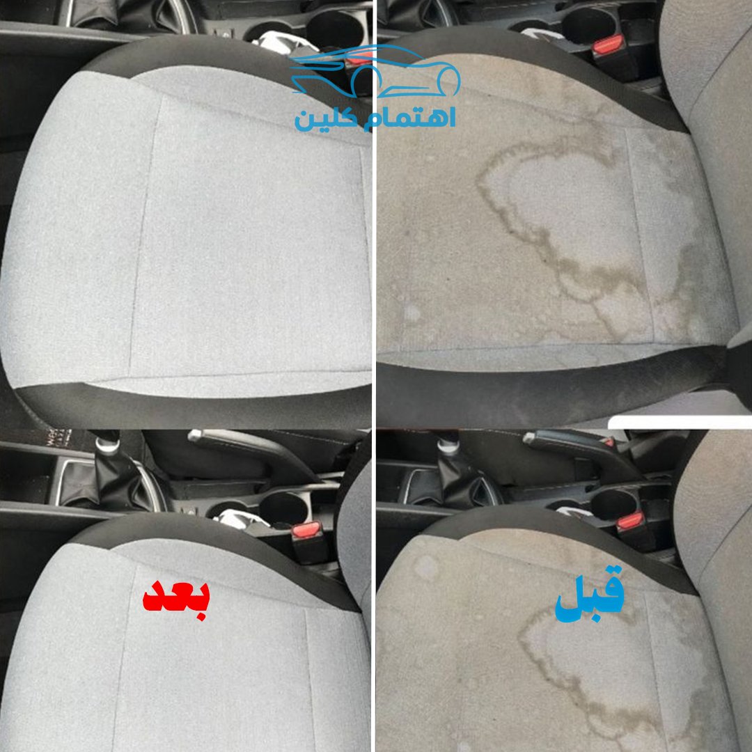 اهتمام [] قبل وبعد 4